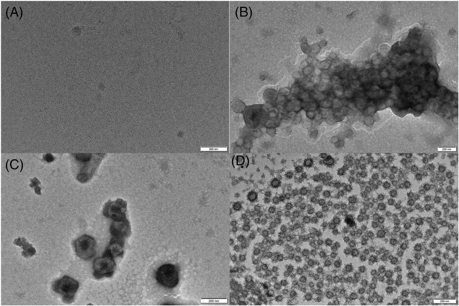1899748196834988032-transmission-electron-microscope-tem-based-exosome-characterization-service2.jpg