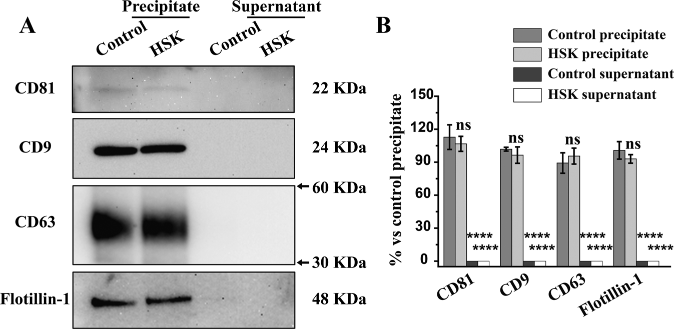 1900116443476381696-western-blotting-based-exosome-characterization-service3.png