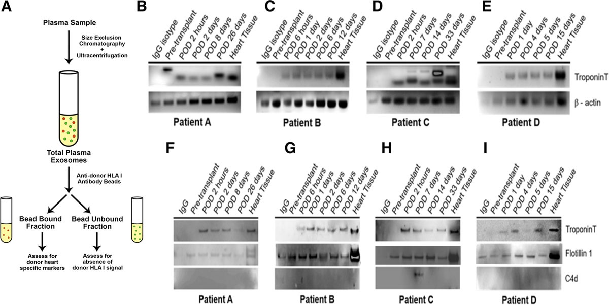 1902645558897135616-allograft-rejection-detection-applied-exosomes-in-organ-transplantation2.jpeg