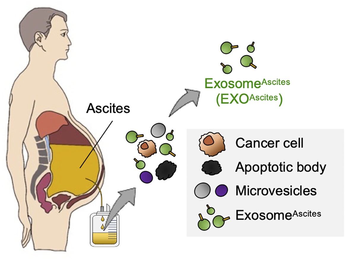 1907716171818979328-ascitic-cell-derived-exosomes-based-vaccines1.jpg