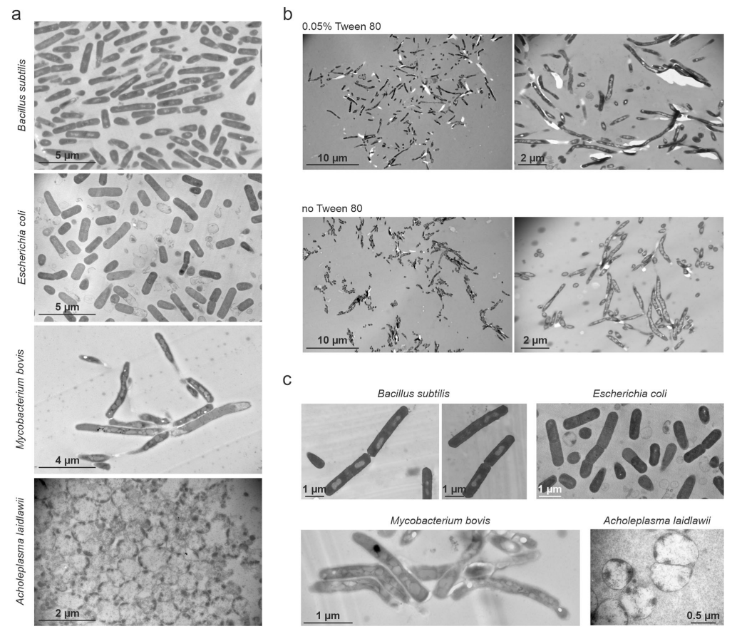1912374056901529600-transmission-electron-microscopy-tem-analytical-service3.PNG