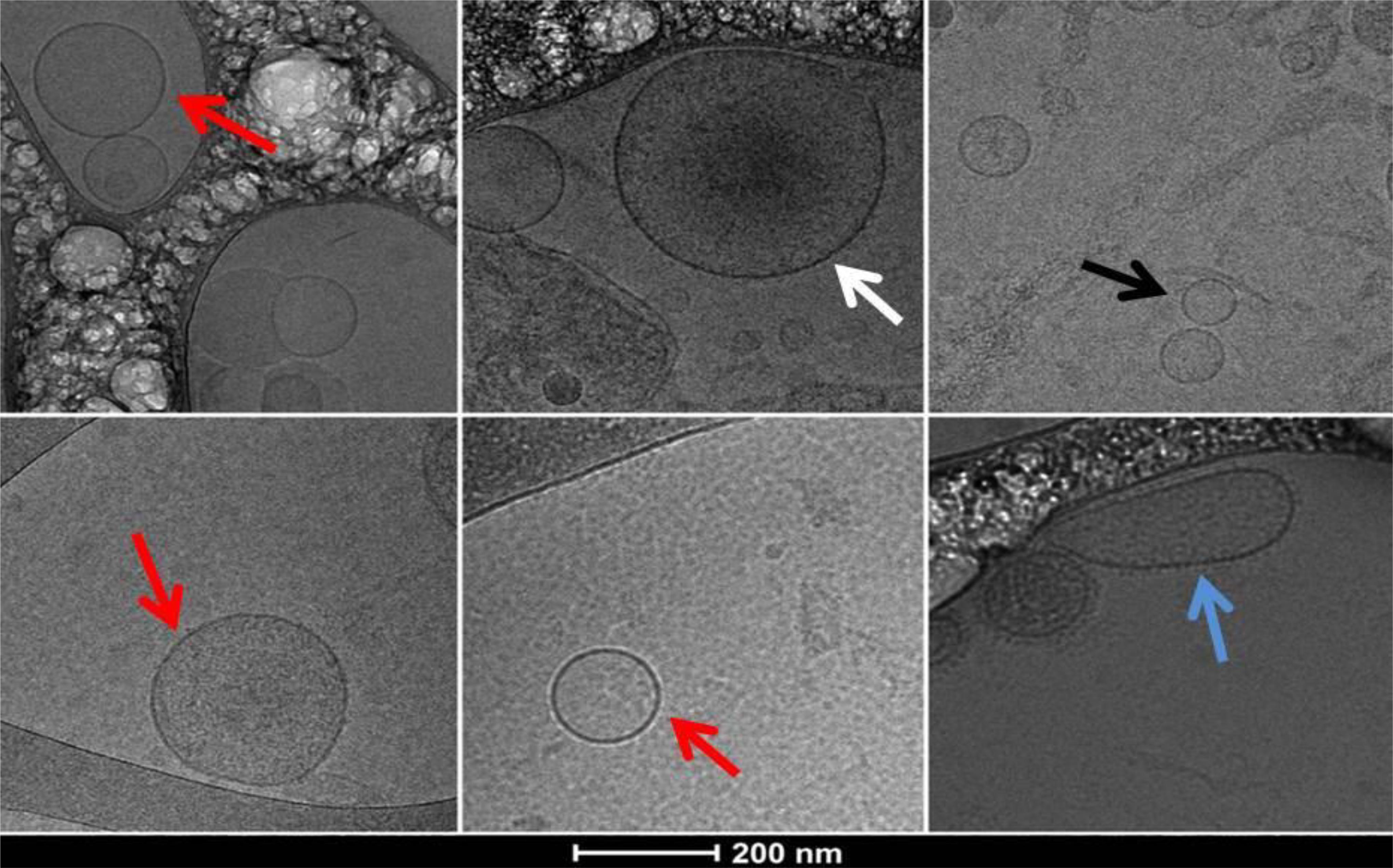 1913109869398446080-cryo-tem-imaging-analysis3.jpg