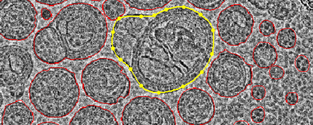 1913159591718932480-lipid-nanoparticles-lnps-structure-characterization-service-cryo-em1.jpg
