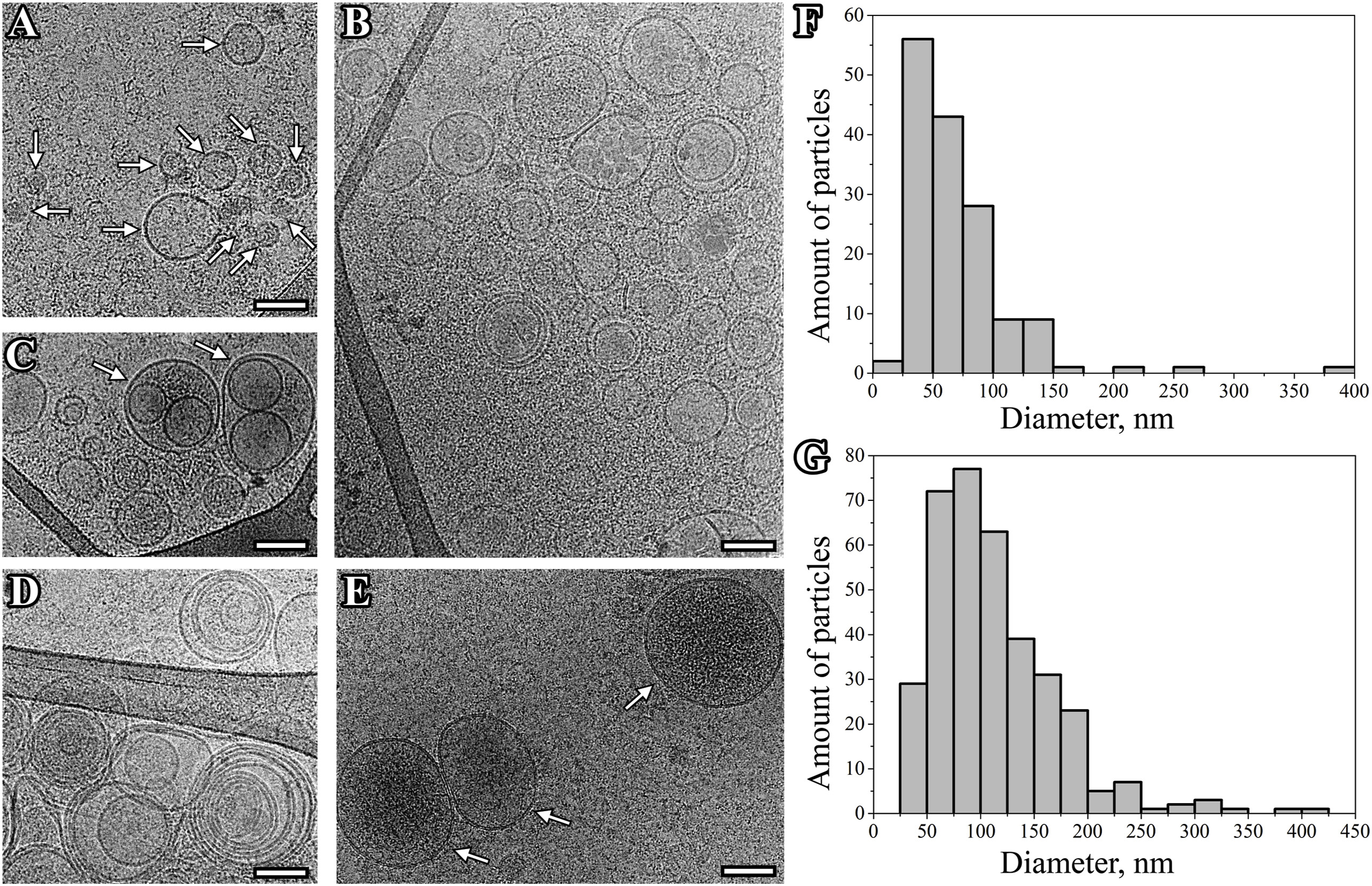 1914970923275505664-extracellular-vesicles-exosomes-structure-characterization-service-cryo-em1.jpg