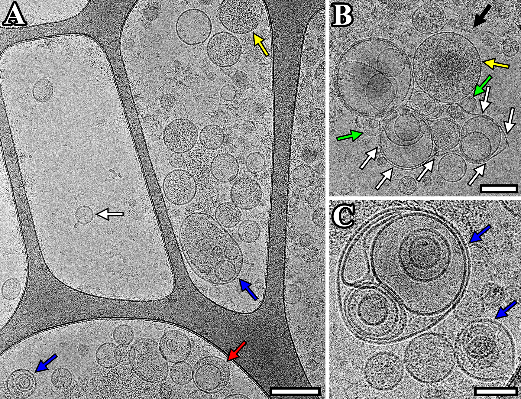 1914971075465826304-extracellular-vesicles-exosomes-structure-characterization-service-cryo-em2.png