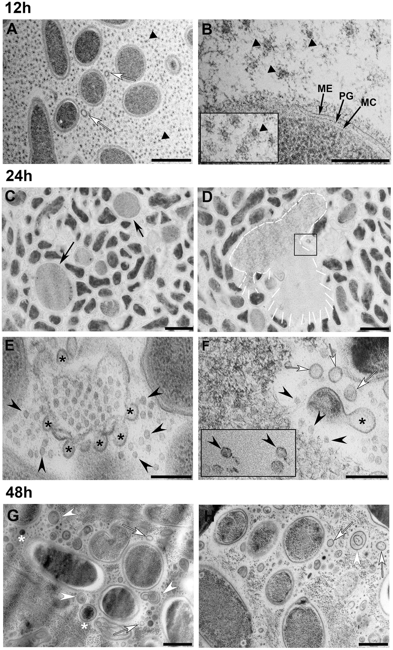 1916418898245832704-lamellarity-blebbing-analysis-service-cryo-em2.jpg