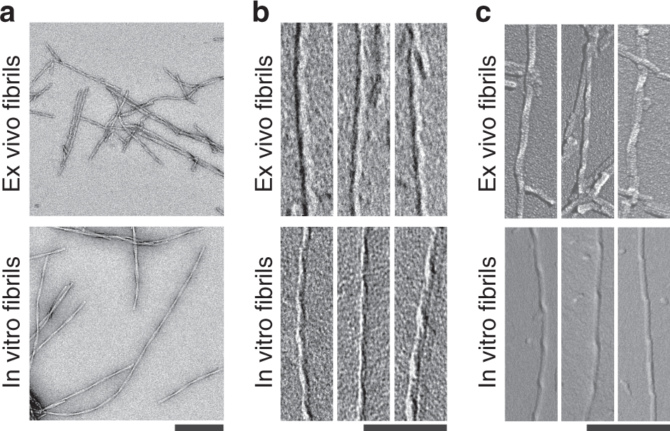 1917127817125548032-cryo-em-for-biological-tissues-structure-characterization-service1.png