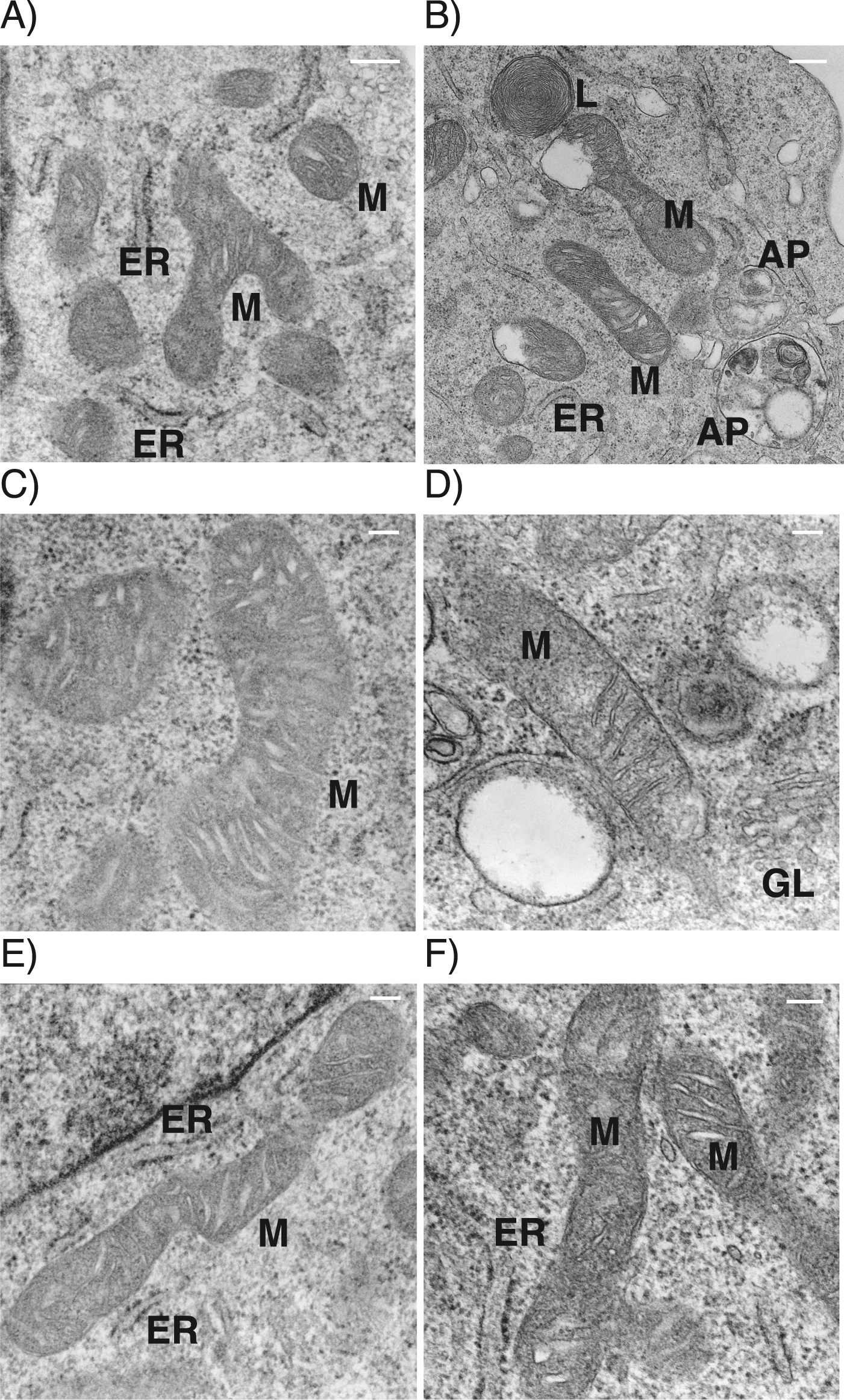 1942873614689357824-electron-microscopy-based-mitochondrial-phenotype-analysis-service1.webp