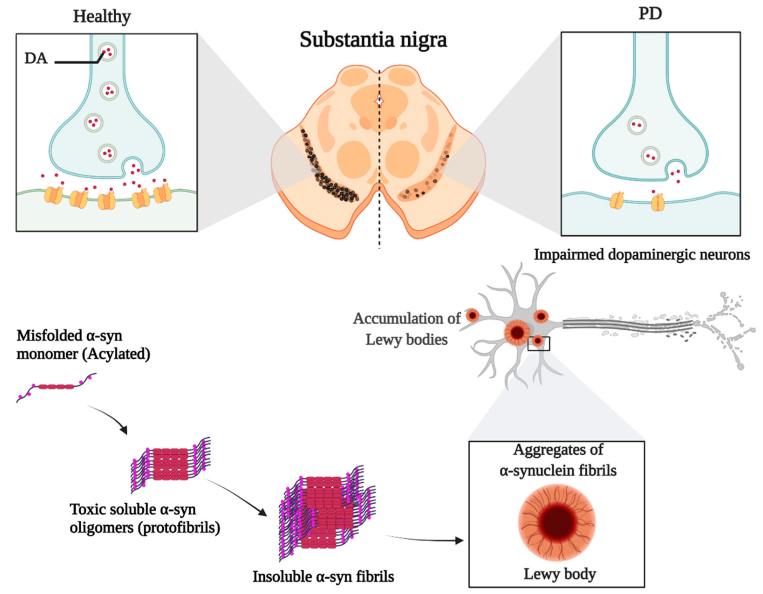 1944649418091909120-parkinsons-disease-exosome-research-service1.png