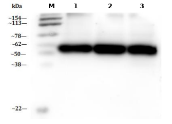 Representative Western Blot Results