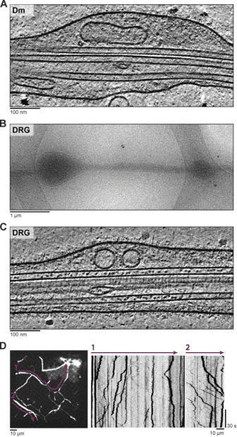 cryo-electron-tomography8.png