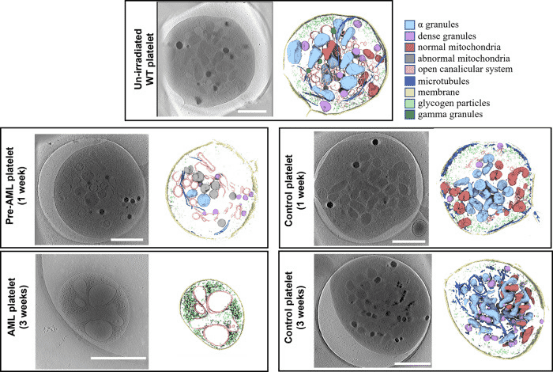 cryo-electron-tomography9.png