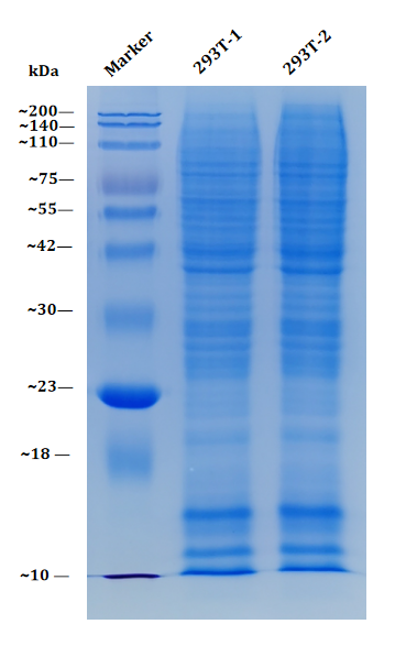 1978694522914312192-SDS-PAGEGelStainedwithCoomassieBrilliantBlue.png